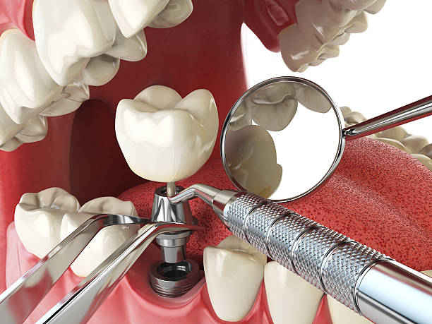 Best Mobile Emergency Dentist in Thomasville, GA