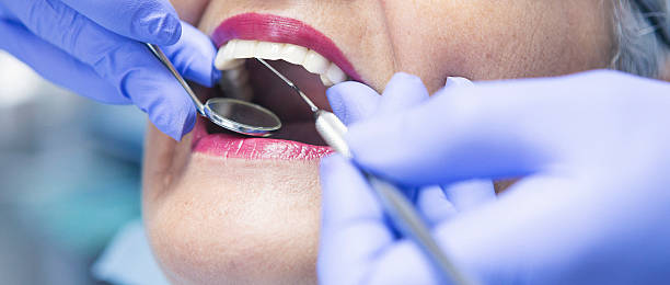 Best Emergency Dentist for Lost Fillings or Crowns in Thomasville, GA